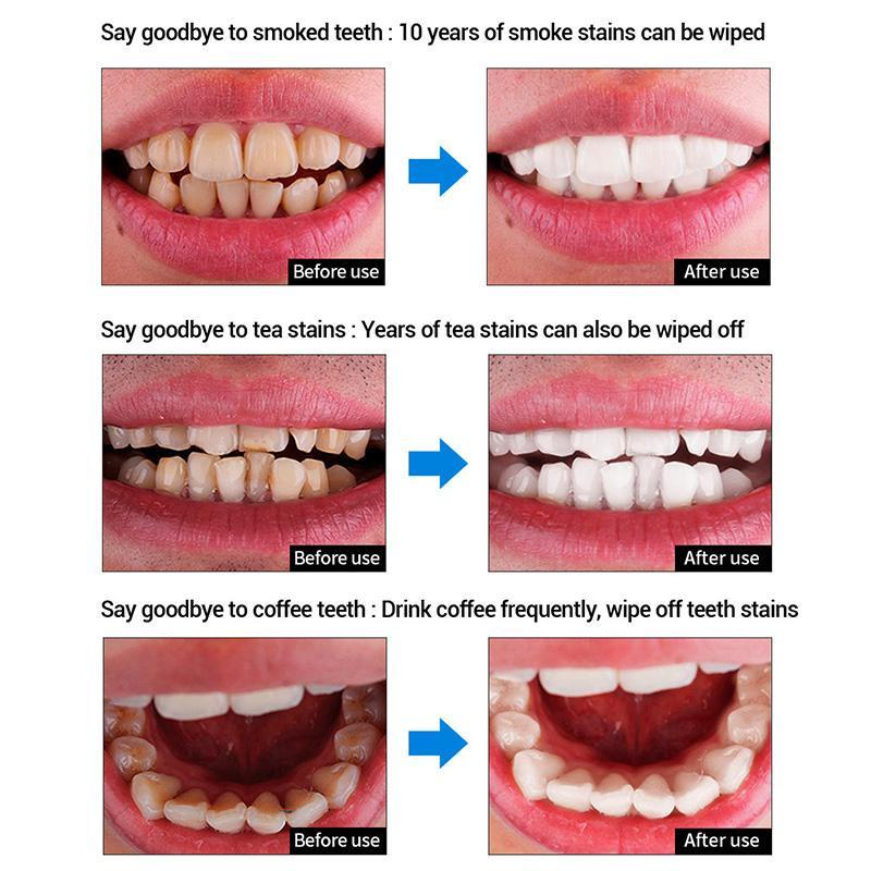 Mint Teeth Whitening Essence Αφαιρεί την πλάκα Κίτρινη βρωμιά των δοντιών Αποκαθιστά την υγεία των ούλων Προωθεί το αναζωογονητικό στόμα