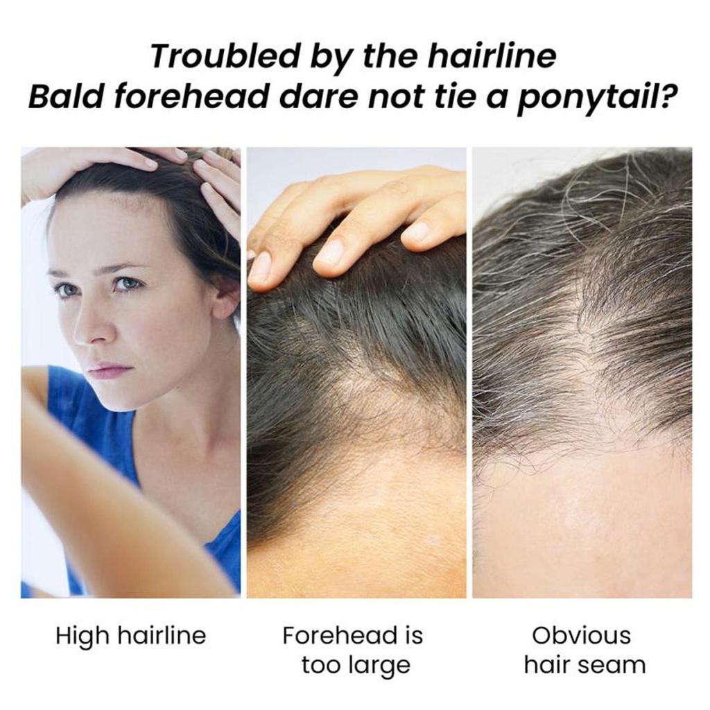 Batana Hair Growth, Promotes Hair Growth, Making Hair, Eyelashes And Eyebrows Thicker And Fuller. Skin Moisturizer  30ml