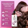 Zwiebel-Shampoo mit Rosmarinöl, Rote Zwiebel & Zimtextrakt für Haarwachstum, Gegen Haarausfall, 236ml