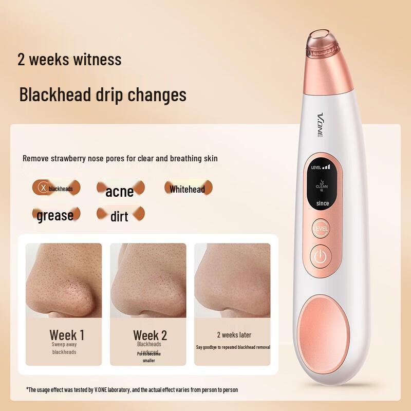 V.ONE Facial Blackhead Remover