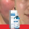 Repair Facial Redness Serum Instant Spider Vein Remove Sensitive Skin Sooth Anti Redness Rosacea Treat Lotion Korean Cosmetics