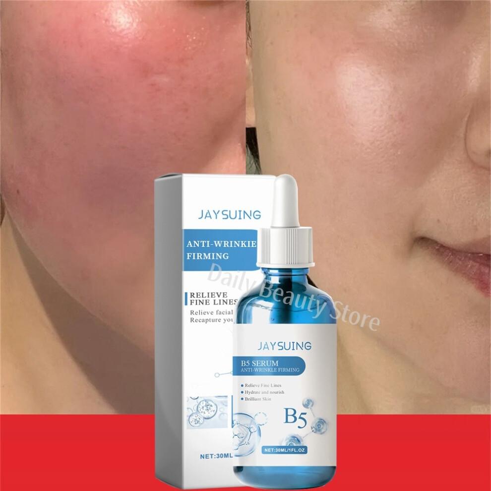 Repair Facial Redness Serum Instant Spider Vein Remove Sensitive Skin Sooth Anti Redness Rosacea Treat Lotion Korean Cosmetics