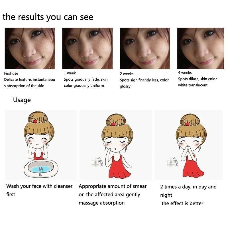 The Latest Horse Oil Freckle Cream, Fade, Stain, Sunburn, Chloasma, Freckles, Facial Care