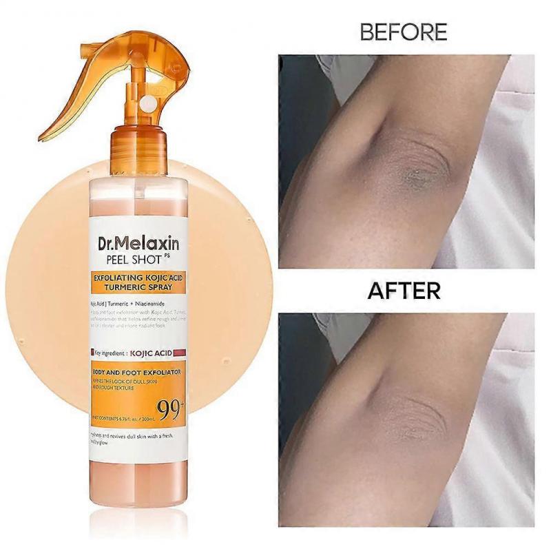 Peel Shot Keratins Care Kojic Säure Kurkuma Peeling Spray für dunkle Flecken Aufhellende Haut Tägliche Anwendung