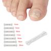 Ingrown Toenail Corrector Tools Pedicure Recover Embed Toe Nail Treatment Elastic Patch Sticker Straightening Clip Brace 13-20MM