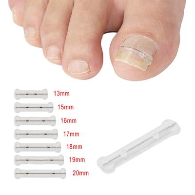 Ingrown Toenail Corrector Tools Pedicure Recover Embed Toe Nail Treatment Elastic Patch Sticker Straightening Clip Brace 13-20MM