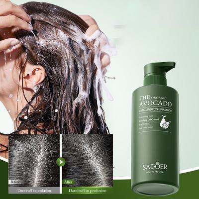 500 ml Avokádový šampon proti lupům a oleji je jemný, hydratační, osvěžující, hladký, vyživující, nadýchaný, čistící a proti lupům.