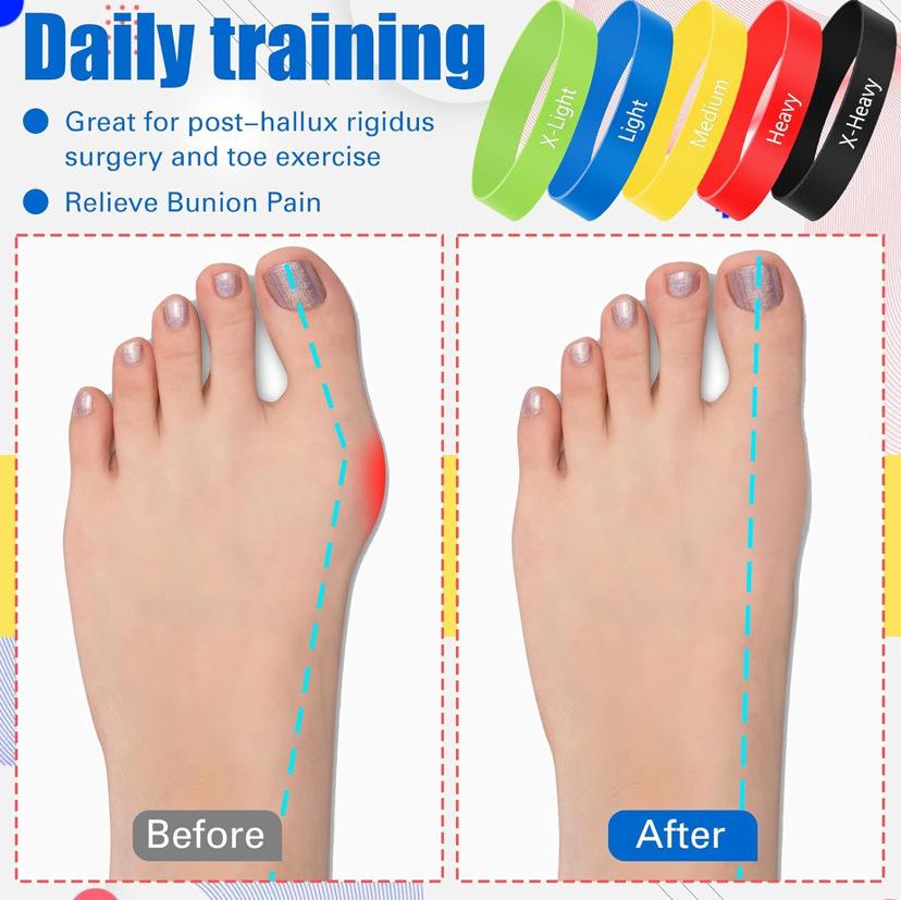5-stufiges TPE Fuß-Widerstandsband-Set mit Aufbewahrungstasche Zehen-Übungsband für Plantarfasziitis Yoga Workout
