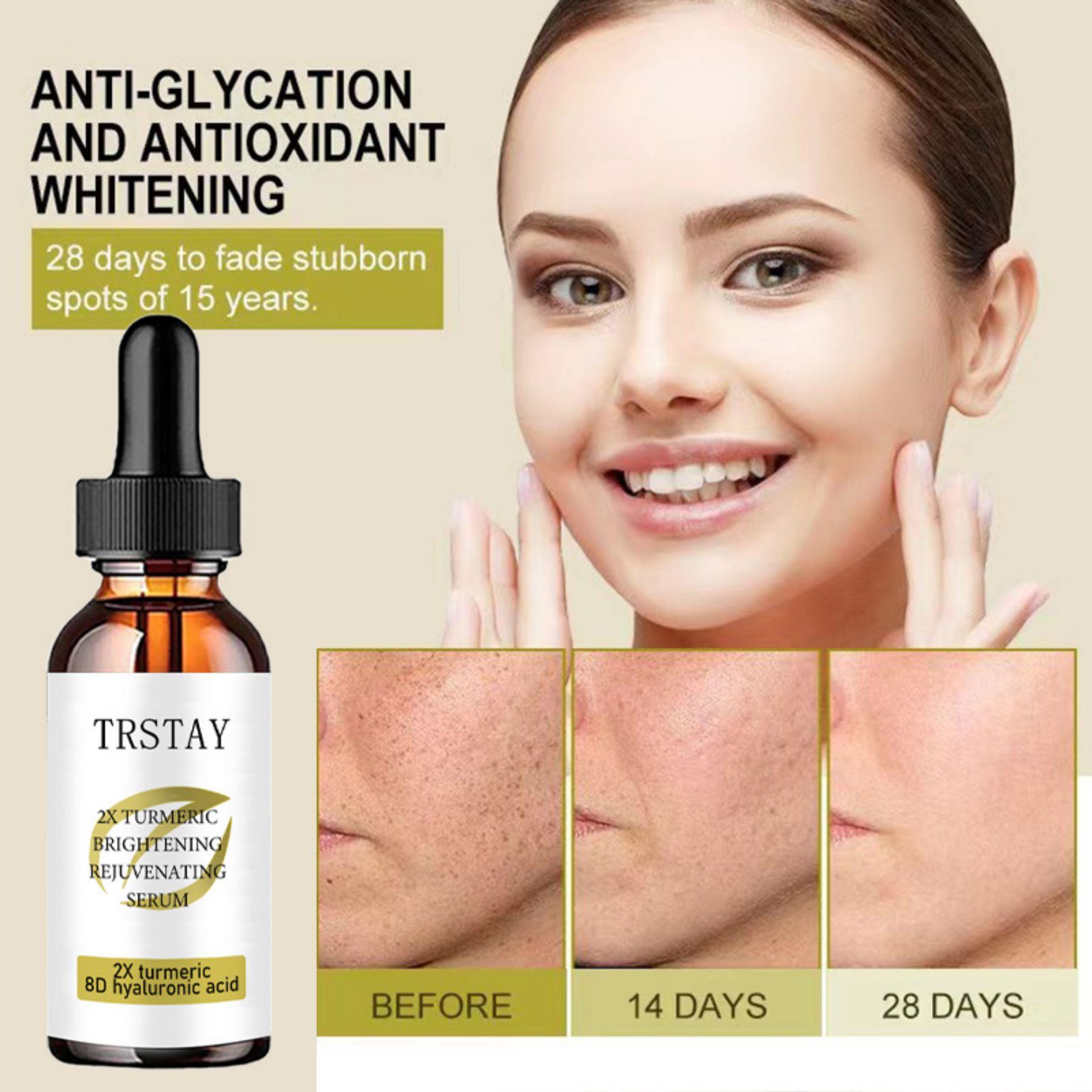 

Сыворотка для интенсивного обновления кожи для женщин, исчезновение темных пятен, отбеливание и осветление кожи