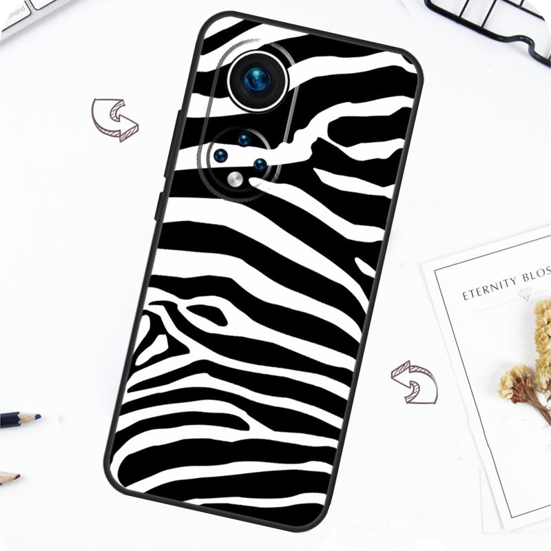 Zebra Skin Print Case For Honor Magic 7 5 6 Pro Honor 200 Pro X9b X9a X8b X8a X8 X9 X9c 50 70 90 Lite Cover