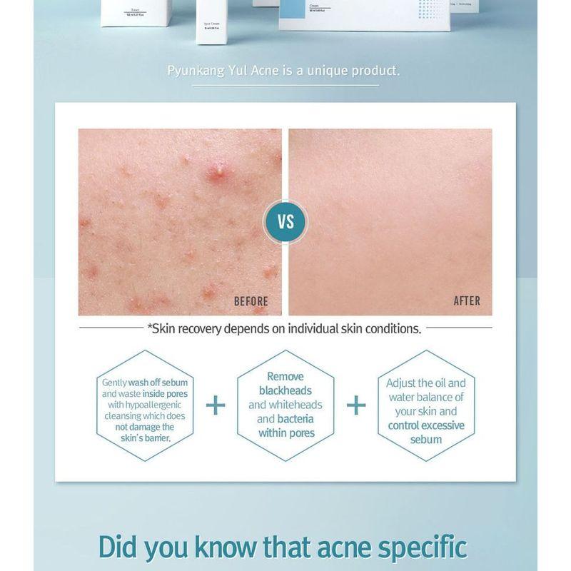 Pyunkang Yul Akne-Gesichtsreiniger 120 ml