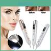 Innovative Electric Spot Removal Pen For Facial Beauty With Usb Functionality In Elegant Champagne Gold And Sleek Silver Colors