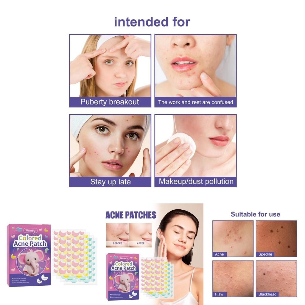 Wiieey Moon Pimple Patches For Diminishing Acne Marks And Concealing Blemishes 144pcs