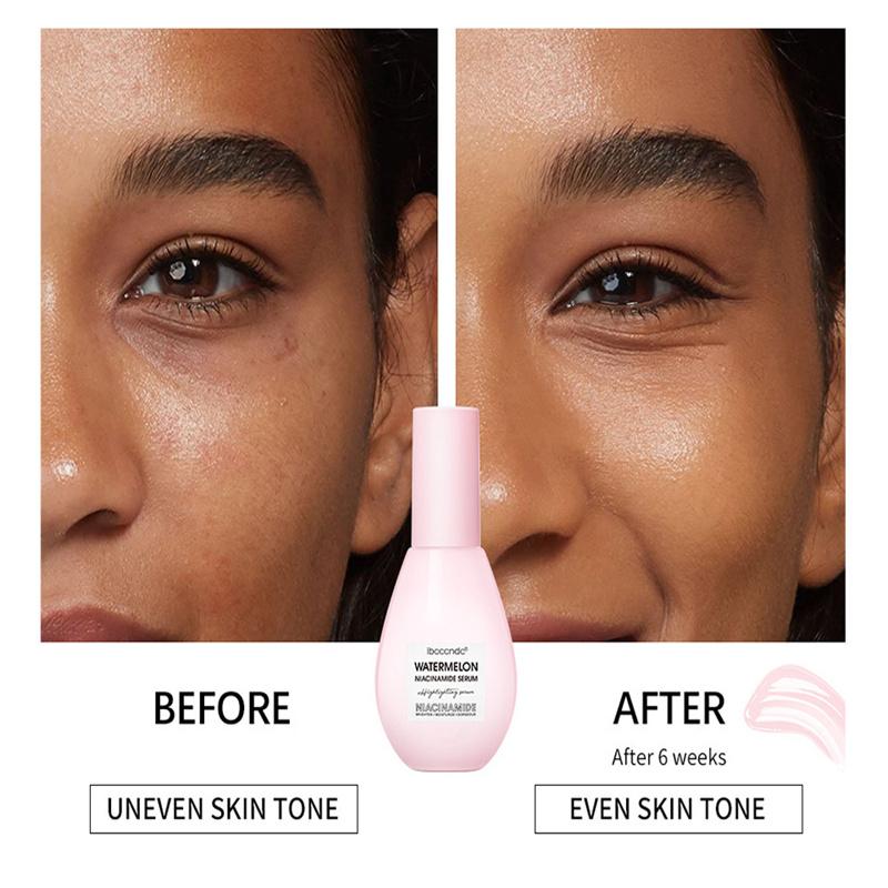 Nicotinamide Essence Watermelon Light Bulb Brightening Essence Hydrating Treasure Moist Face Essence