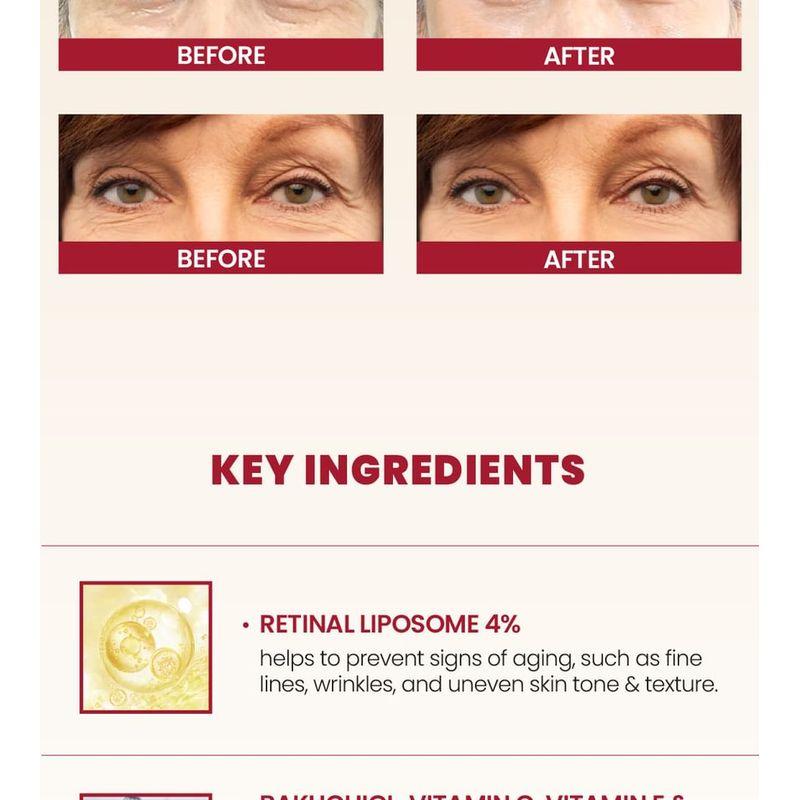 KSECRET SEOUL 1988 Augencreme : Retinal-Liposom 4% + Fermentiertes Bohnen-Bündel-Set