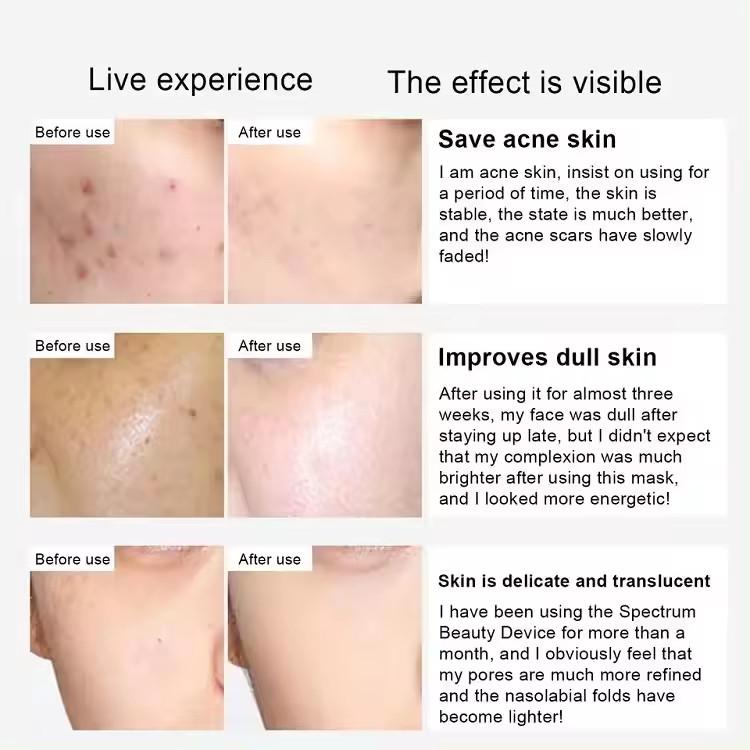 PDT 7 Color LED Photon Therapy Facial PDT LED Light Therapy Whitening and Rejuvenation Beauty Machine Photon Skin Rejuvenation and Acne Removal