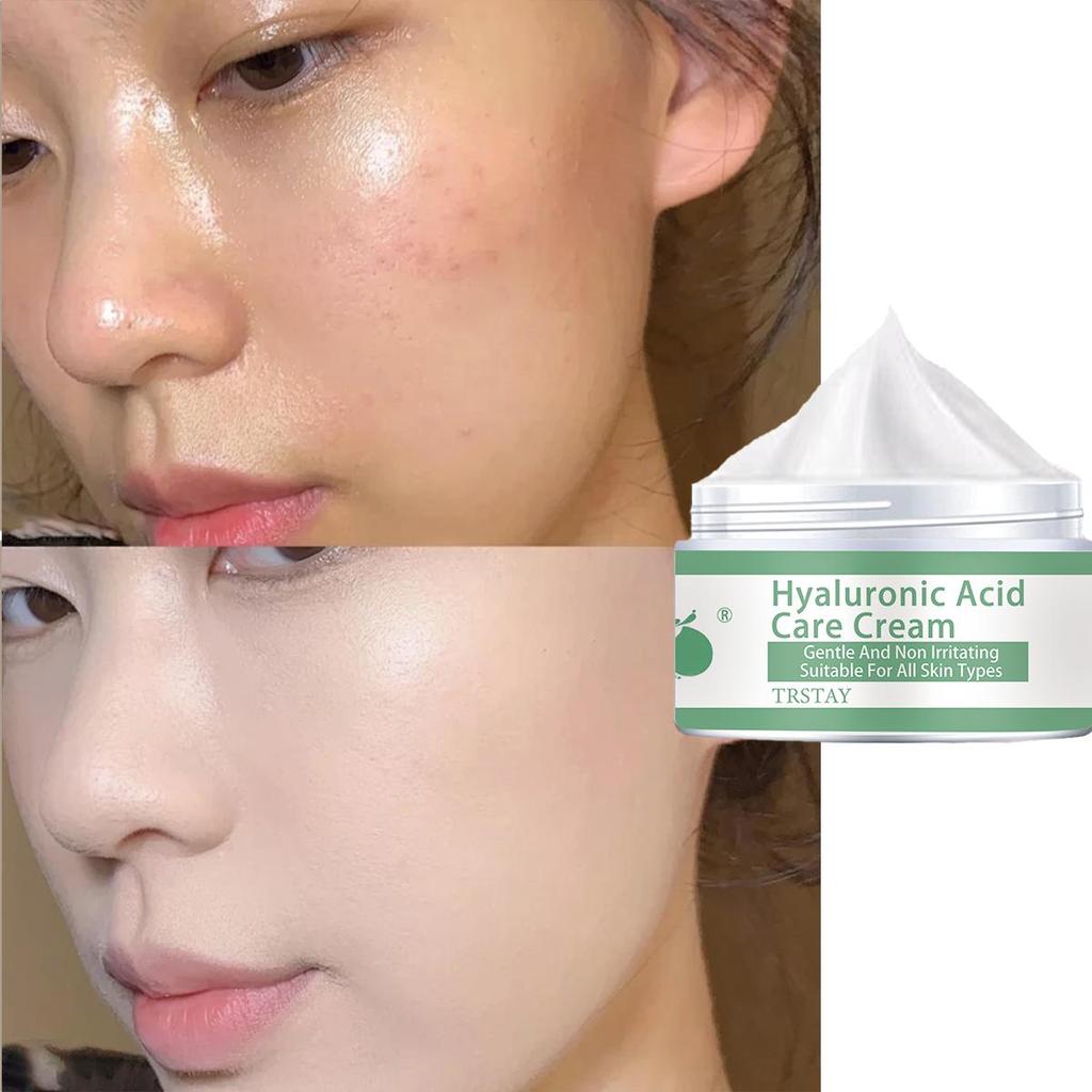 TRSTAY Vitamin C For Face Cream Pigments Dark Spots Removal Whitening Facial Cream Lightening Skin Care Products Beauty Health