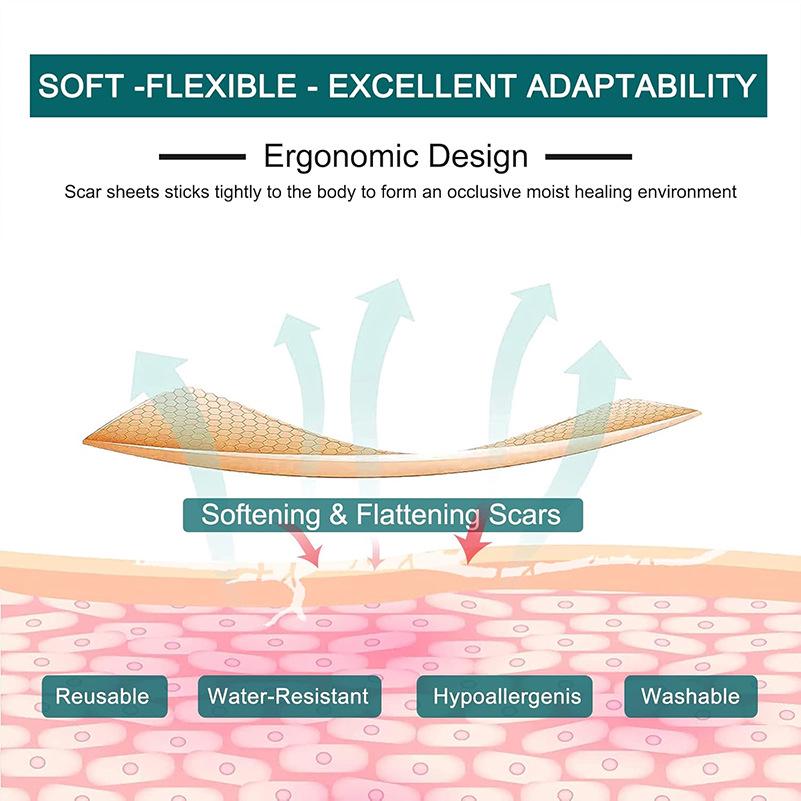 Cross-Border Silicone Scar Sheets - Beauty Skin Care Silicone Tape Roll