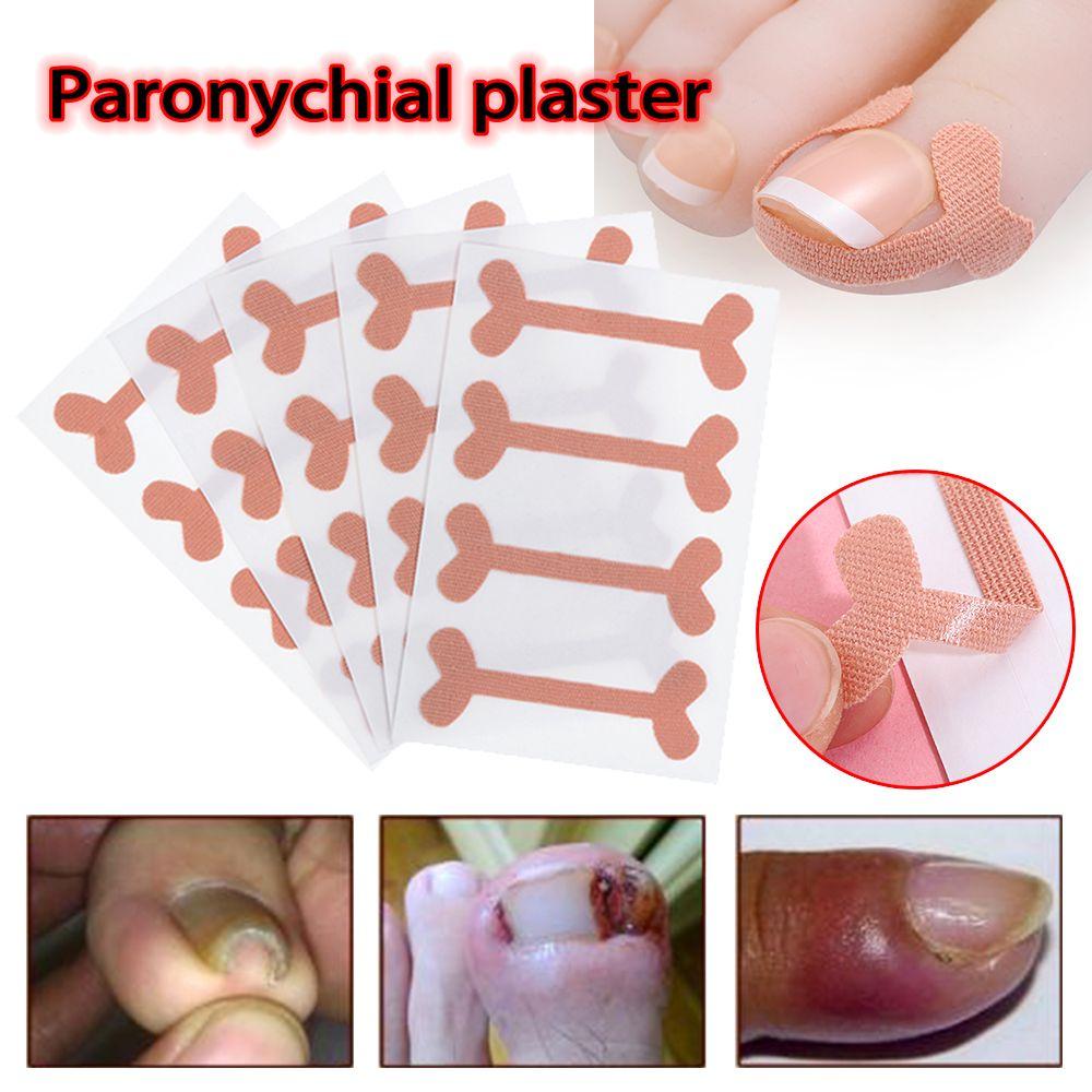 

Инструменты Уход за ногтями на ногах Восстановление ногтей на ногах Вросший ноготь на ноге Лечение паронихии Наклейки для коррекции ногтей