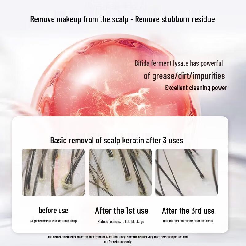 Cai Le Bifida Ferment Scalp Cleansing Milk 80ml