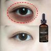 Active Retinol Eye Cream Anti Wrinkle Reduce Fine Lines Improve Dark Circles Anti Puffiness Anti Aging Eye Skin Care