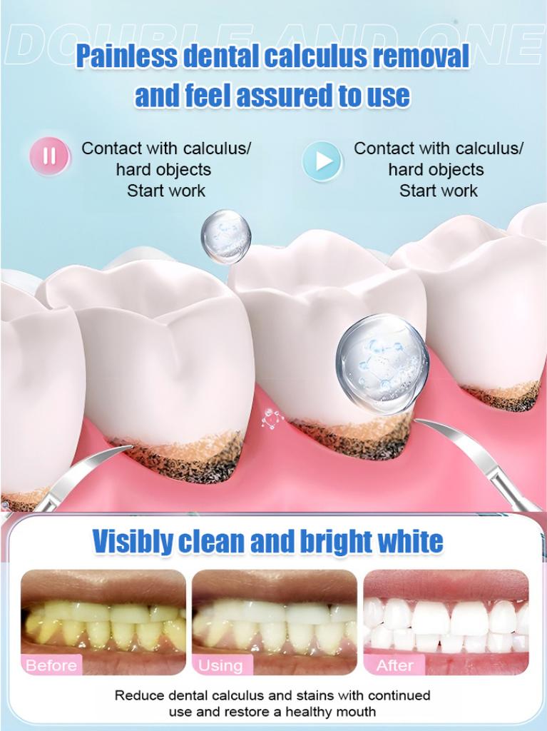 Home Flosser Ultrasonic Tooth Cleaner Removes Yellow Teeth Deep Cleans And Cares For The Oral Cavity