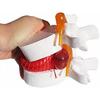 BoNew-Oral 1:1.5 Anatomical Human Lumbar Vertebrae Degenerative Lumbar Human Spine Model White Color