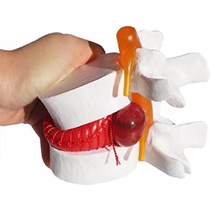 BoNew-Oral 1:1.5 Anatomical Human Lumbar Vertebrae Degenerative Lumbar Human Spine Model White Color