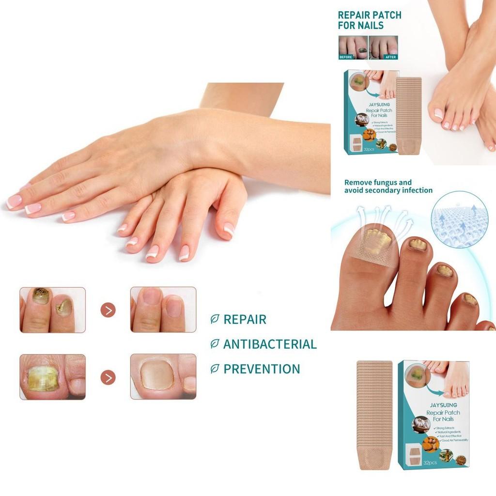 Jaysuing Nährende Nagelreparatur-Pflaster für starke und gesunde Nägel mit Weichgel-Formel