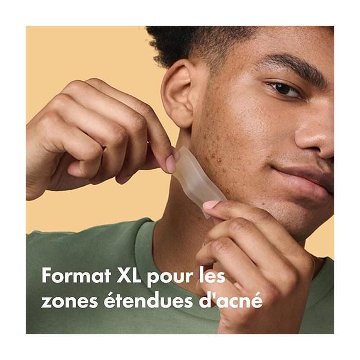 Patchs Anti-Acné - Hero - Mighty Patch - 10 Patchs - Hydrocolloïdes - Hypoallergénique