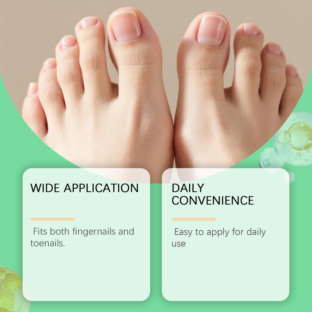 Nail Care Repairing Broken Stratum Corneum  Stratum Corneum Oil  Dry Stratum Corneum Care 11ml