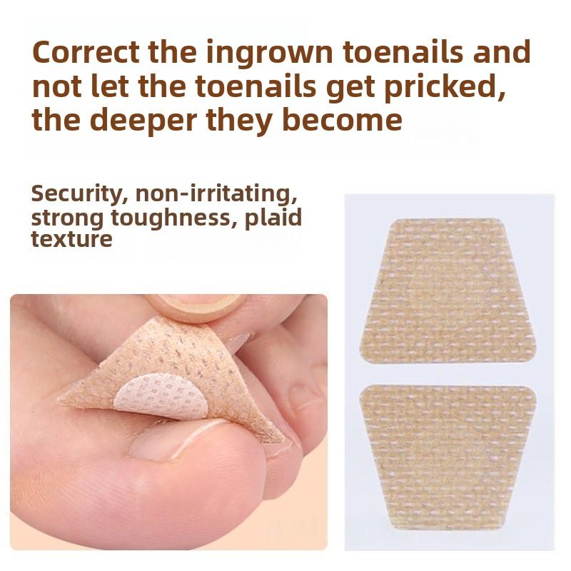 10/20 Pairs Nail Care Patch Inlay Nail Groove Into the Meat Toe Pad Screen Protector Long Soft Nail Gray Nail Orthopedic Sticker
