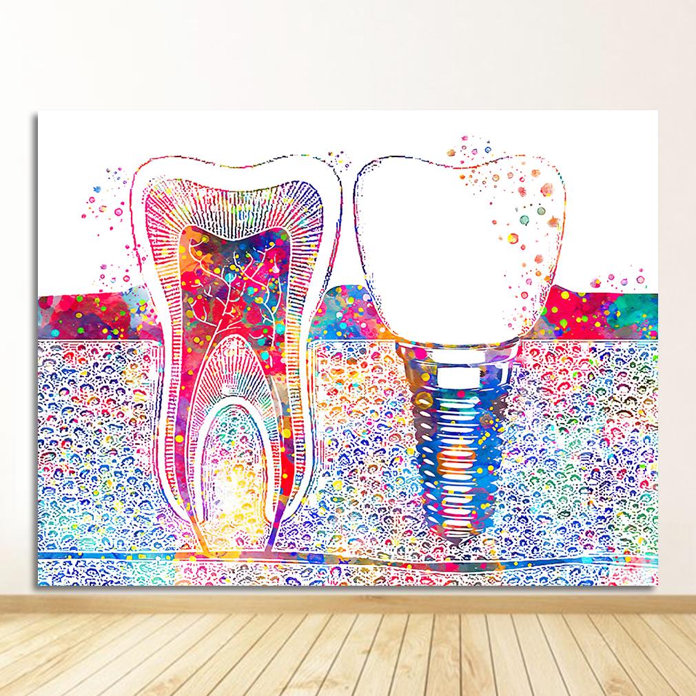 Canvas Print Dentist Wall Art Painting Medicine Hygienist Poster Tooth Watercolor Clinic Decor Dental Art Picture Tooth Implant