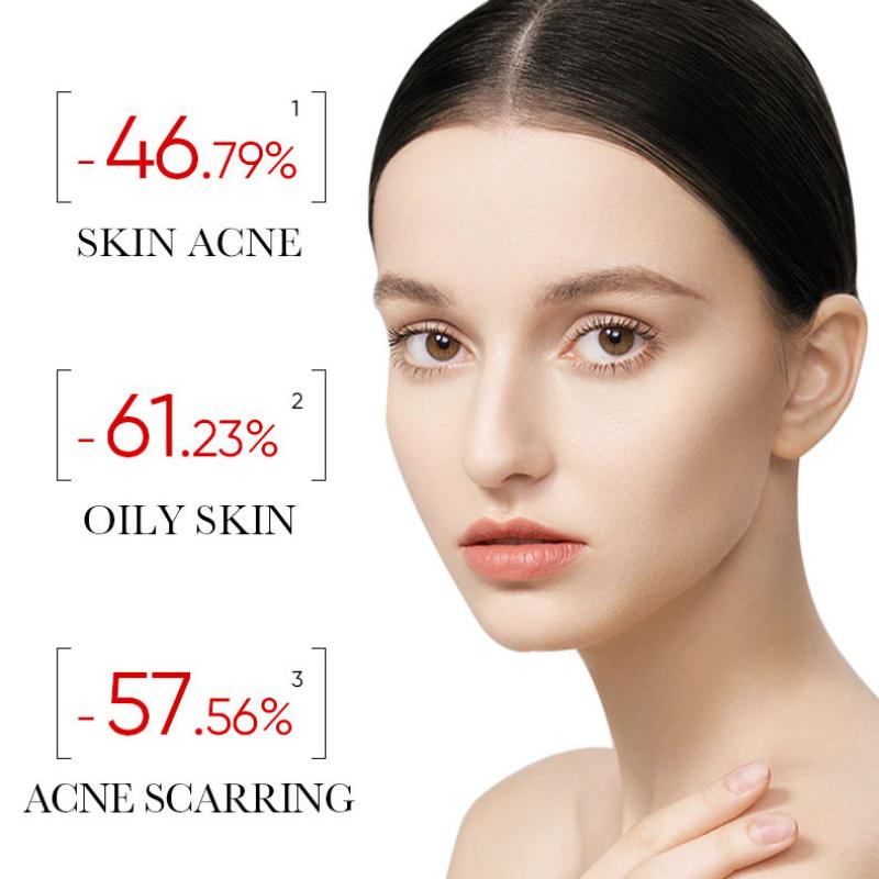 Acne Serum SADOER Fruit Acid Dilutes Acne Marks, Hydrates and Moisturizes