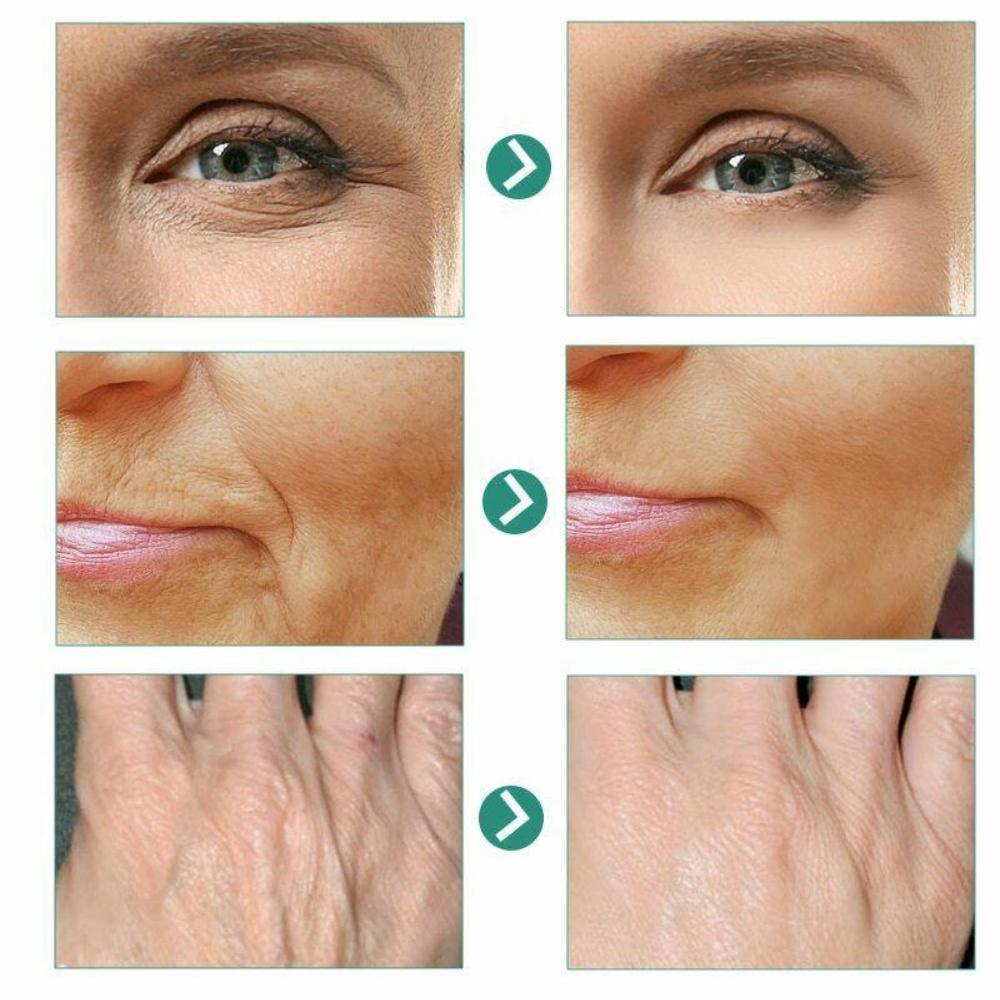 5 secunde pentru îndepărtarea ridurilor Cremă de față anti-îmbătrânire instantanee Întărirea pielii Fermitate