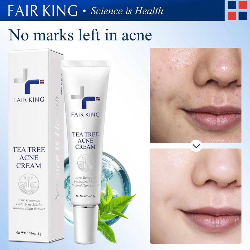 FAIRKING Tea Tree Acne Cream - Oil Control & Acne Treatment 15g