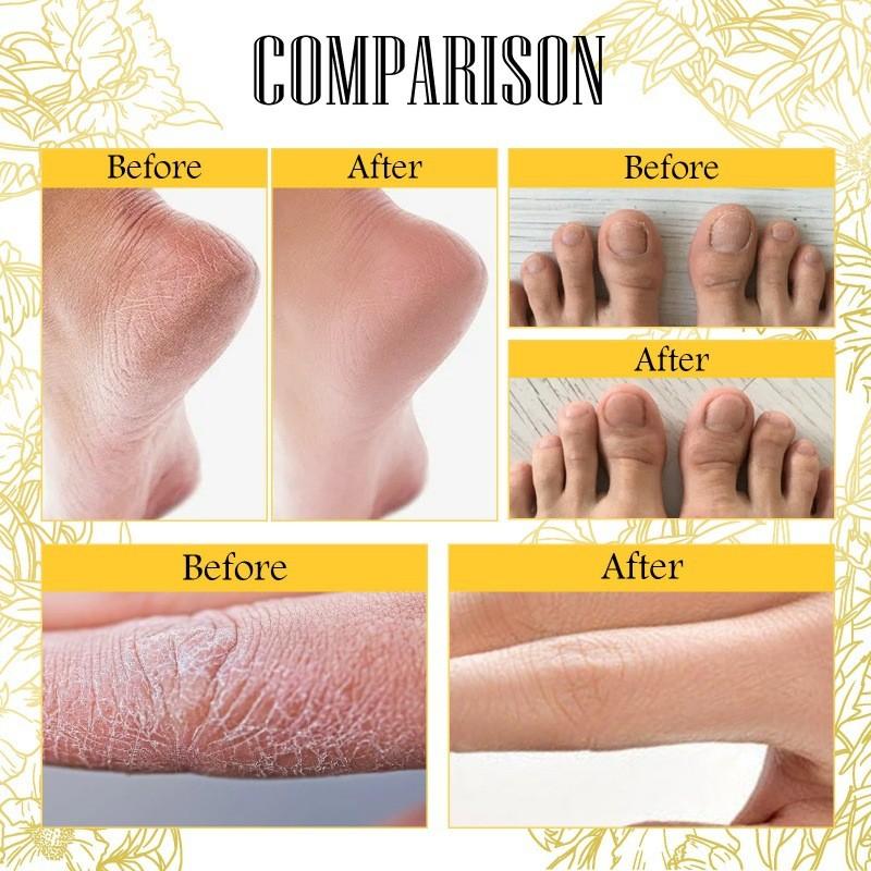 Jaysuing Three Flower Three Seed Hand And Foot Essence Oil For Deep Moisturizing Skin