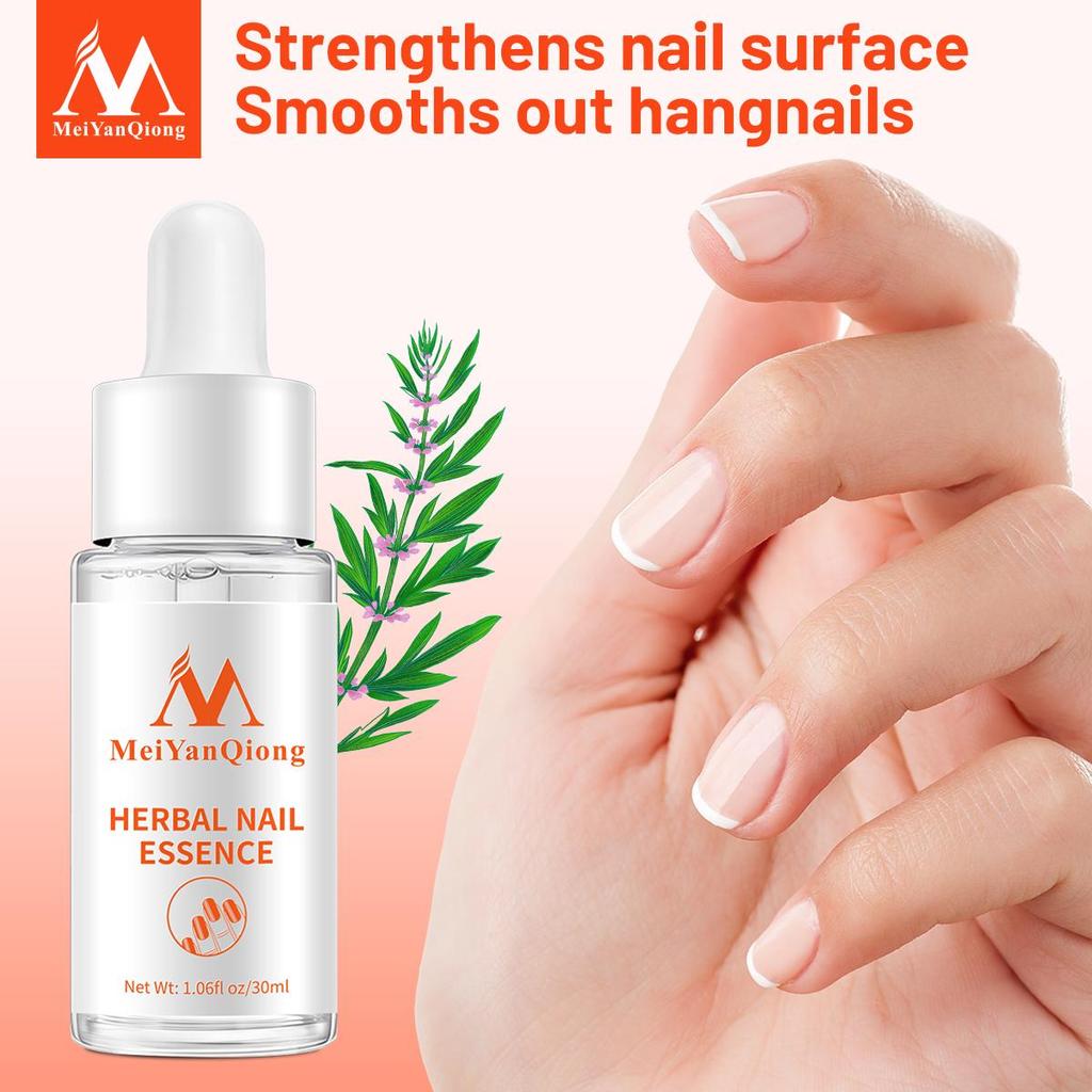 MeiYanQiong Nail Repair Nail Feet Care Essence Nail Foot Whitening Toe Nail Removal Gel