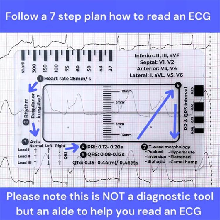 Electrocardiogram Assessment Tool 7 Step Ruler Card For Hospitals Clinics Healthcare Professional And Medicals Students