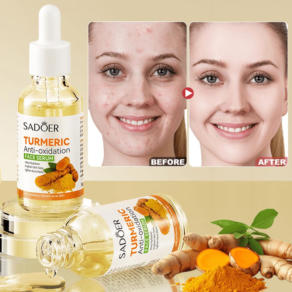 1PC Turmeric Essence, Hydrating And Refreshing The Face,Deep Hydration,Brighten Skin,Lighten Fine Li