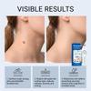 7 Day Skin Tag & Dark Spot Remover Pen Suitable for Beginners for At Home Daily Facial Skincare Use 1Pcs