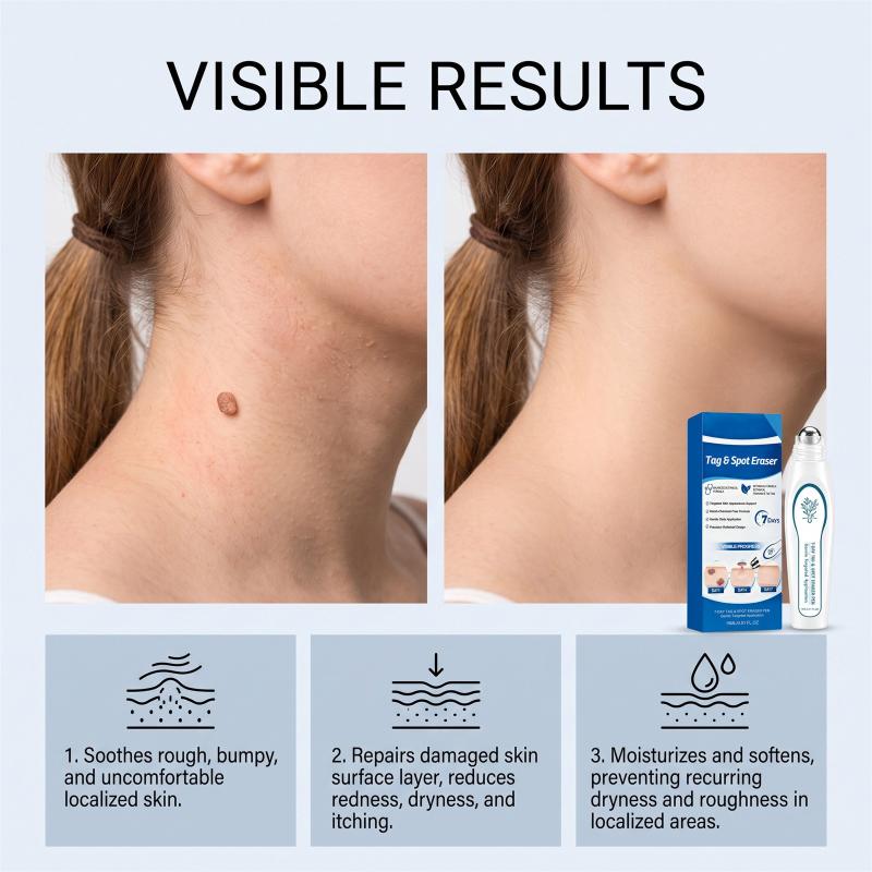 7 Day Skin Tag & Dark Spot Remover Pen Suitable for Beginners for At Home Daily Facial Skincare Use 1Pcs