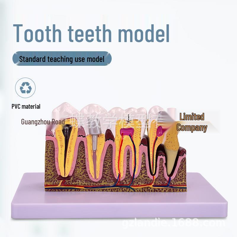 Large Kindergarten Oral Health Toothbrushing Model for Early Education