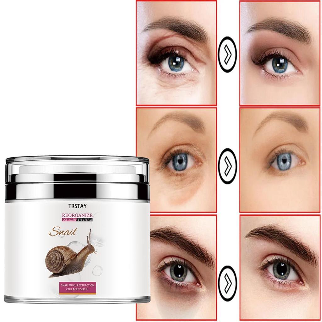 Eye cream, tightening crow's feet, moisturizing, fine lines, massage, massage eye cream around the eyes