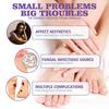 1/3/5PCS Nail Fungus Spray Reduce Beriberi Deodorize Remove Onychomycosis Paronychia Deeply Mild Cleansing Nail Care Spray