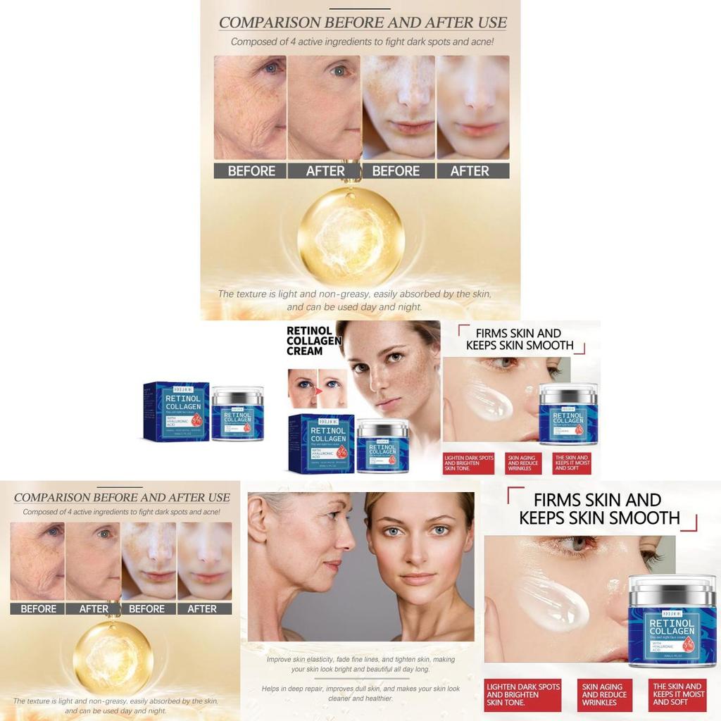 Eelhoe Retinol Collagen Cream For Smooth Radiant Skin Reduces Fine Lines And Dark Spots