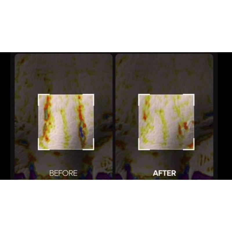 Dr.Melaxin Facephalt Tightening Cream