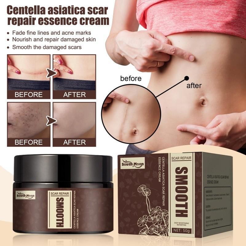 South Moon Centella Scar Repair Cream Moisturizing Skin Tightening And Smoothing Formula For Scars And Blemishes