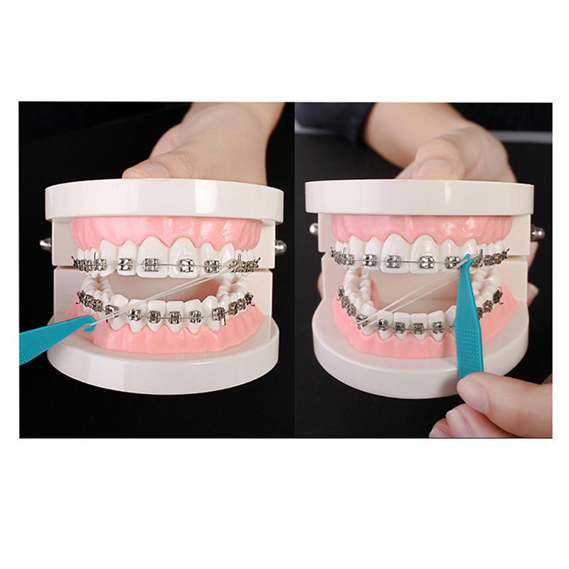 Buy 20Pcs Dental Material Orthodontic Correction Rubber Band Hook