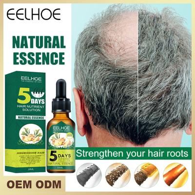 Ätherisches Ingwer-Haarpflegeöl, 7 Tage, verbessert die Kopfhautumgebung, Haarausfall-Behandlung, Haarwuchs-Essenzöl, 30 ml